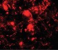 ULK2 Antibody (Internal)